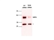 Measuring SIRT6 Knockdown in HeLa Cells by Western Blot