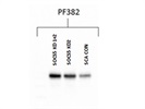 Mouse Lck Antibody for Western Blot