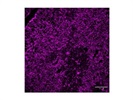 PanCK for Thymic Epithelial Cells