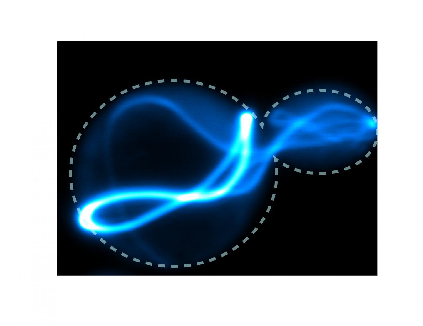 prion