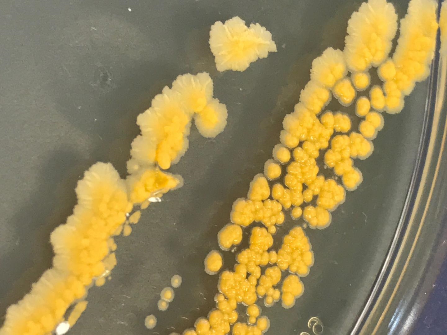 cryopreservation
