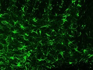 Immunohistochemistry with GFAP