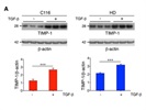 Good TIMP-1 Antibody for Western Blotting
