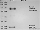 Good Antibody to Detect Human TGF Beta 1 Under Non-Reducing Conditions