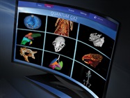In vivo or ex vivo, this is microCT imaging that goes beyond bone
