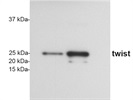 Good Antibody to Detect Human Twist Protein