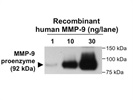 Excellent Antibody to Detect Human MMP-9