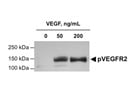 Good Antibody to Detect Activated VEGFR2