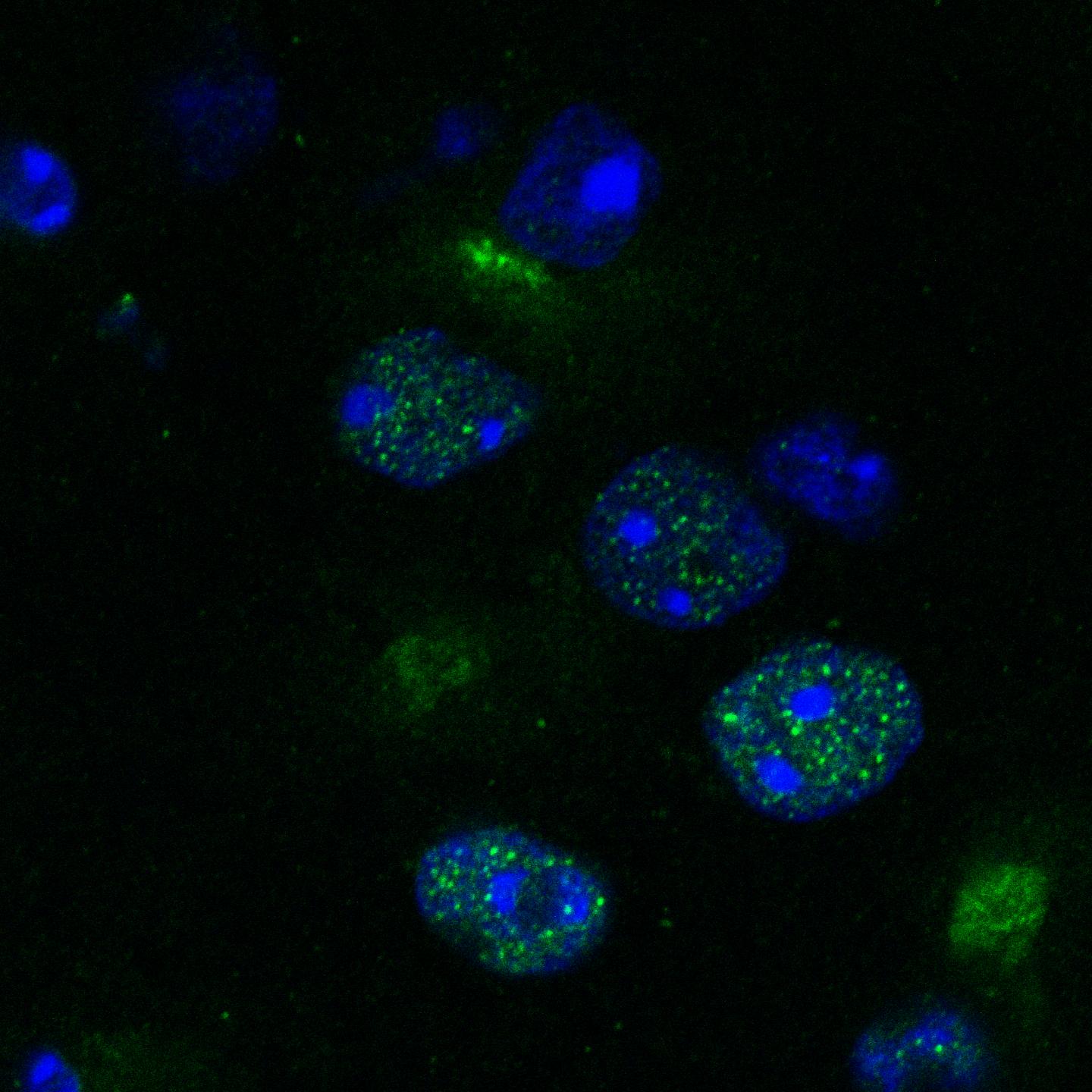 Kinases