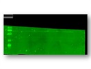 Anti-TRPC5 Tried in Human Tissue Sample