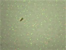 Cell Count and Viability Using the LUNA-FL