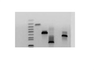 For Quick DNA Extraction From Agarose Gels