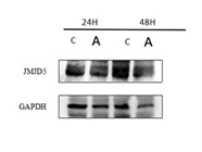 JMJD5 Antibody for Western Blot