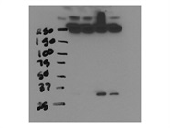 Decent Antibody for Cyclin D1