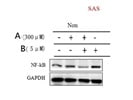 Great NFkB Antibody for Western Blot