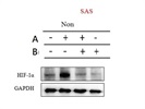 Great HIF1 Antibody for Western Blot