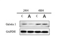 Great Galectin 1 Antibody for Western Blot