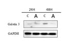 Great Galectin 3 Antibody for Western Blot