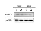 Galectin 7 Antibody for Western Blot