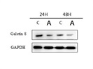 Galectin 8 Antibody for Western Blot