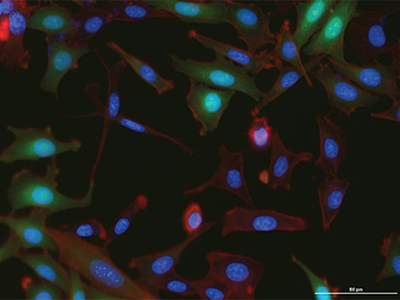 stained NIH 3T3 cells expressing GFP
