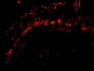 A Rabbit Polyclonal mCherry Antibody That Can Label tdTomato