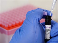Watch Video: Immunofluorescence Tissue Staining