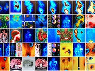 In Vivo Imaging Roundtable: Building on Breakthroughs