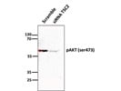 Excellent Antibody for Western Blot