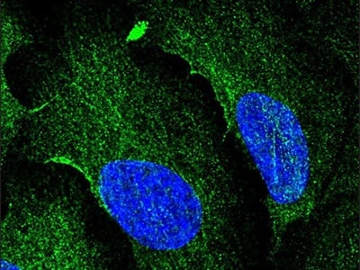  Tips for IHC Optimization
