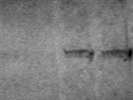 Antibody for Stat1 Phosphorylation at Tyr701
