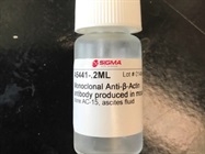 Identification of Antibody for Loading Control