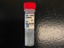 Detect Protein of Interest Using Anti-Rabbit Secondary Antibody