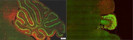 cerebellum