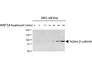 Active ß-Catenin Antibody for Western Blotting