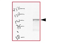 Axin1 Antibody for Western Blotting