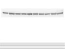 Actin for Normalizing Western Blot