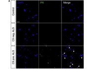 Mounting Media Is Great, but DAPI Is Tricky