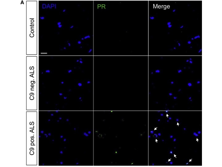 Mounting Media Is Great, but DAPI Is Tricky Kit