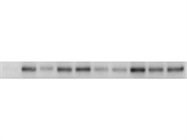 Great Antibody for Detecting p-FOXO1 Levels at Ser256