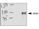 Axin2 Antibody for Western Blotting