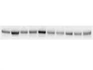 Bright Band in Western Blot for FoxO1