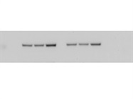 Bright Band in Western Blots for Phospho-Akt