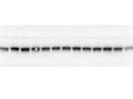 Bright Band in Western Blot for PRMT1