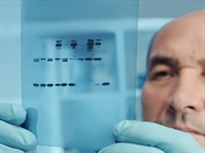 Improving Western Blot Reproducibility: Antibodies to Automation