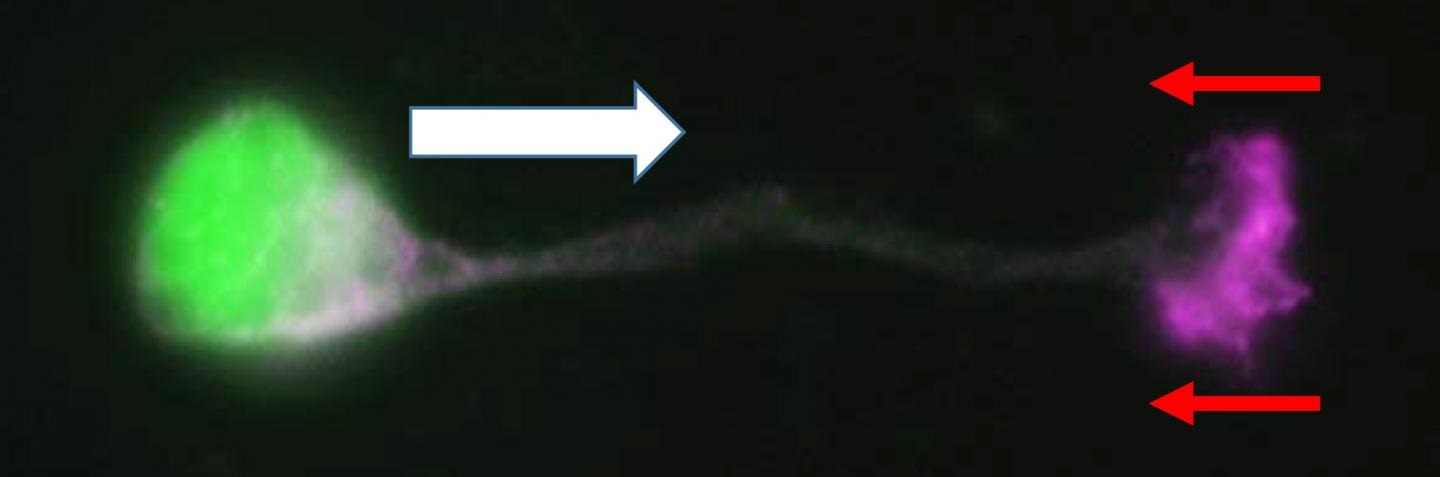 neuronal migration