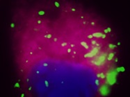 Lamp-1 Expression in THP-1 Cells