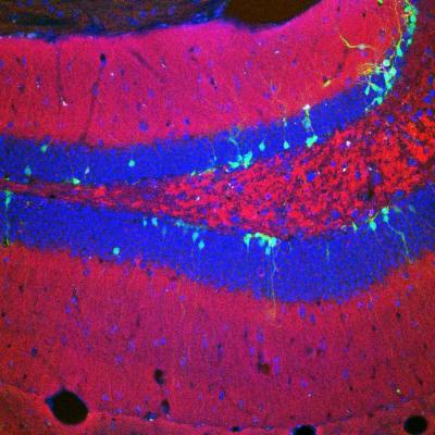 Dentate Gyrus 