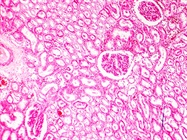 Getting More Out of IHC
