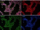 Great Nestin Antibody from GeneTex for Immunocytochemistry